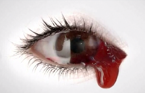 The Eye